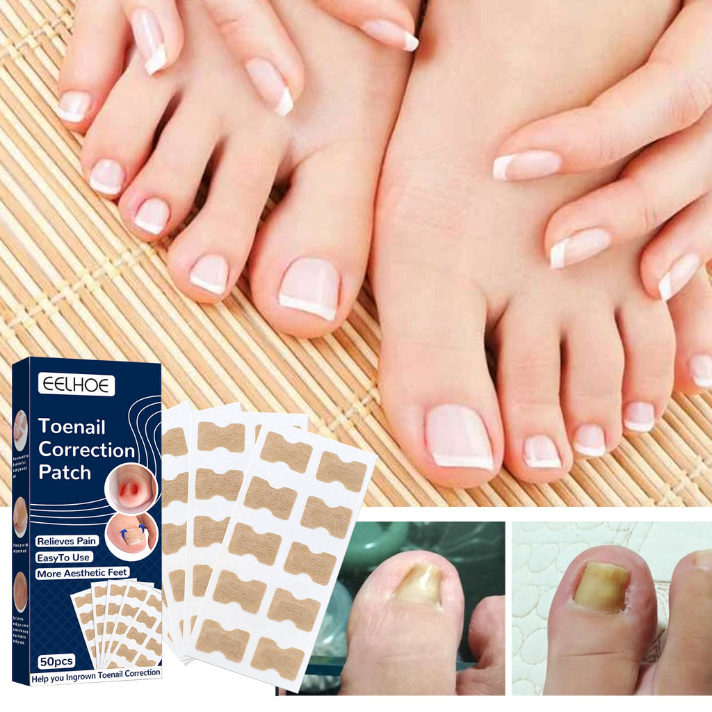 Toe Nail Care Patches — Cushioning Comfort Support for Nails — product photo 2