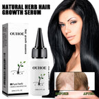 Herbal Dense Hair Essence — Scalp Nourishment for Fuller-Looking Hair — product photo 2