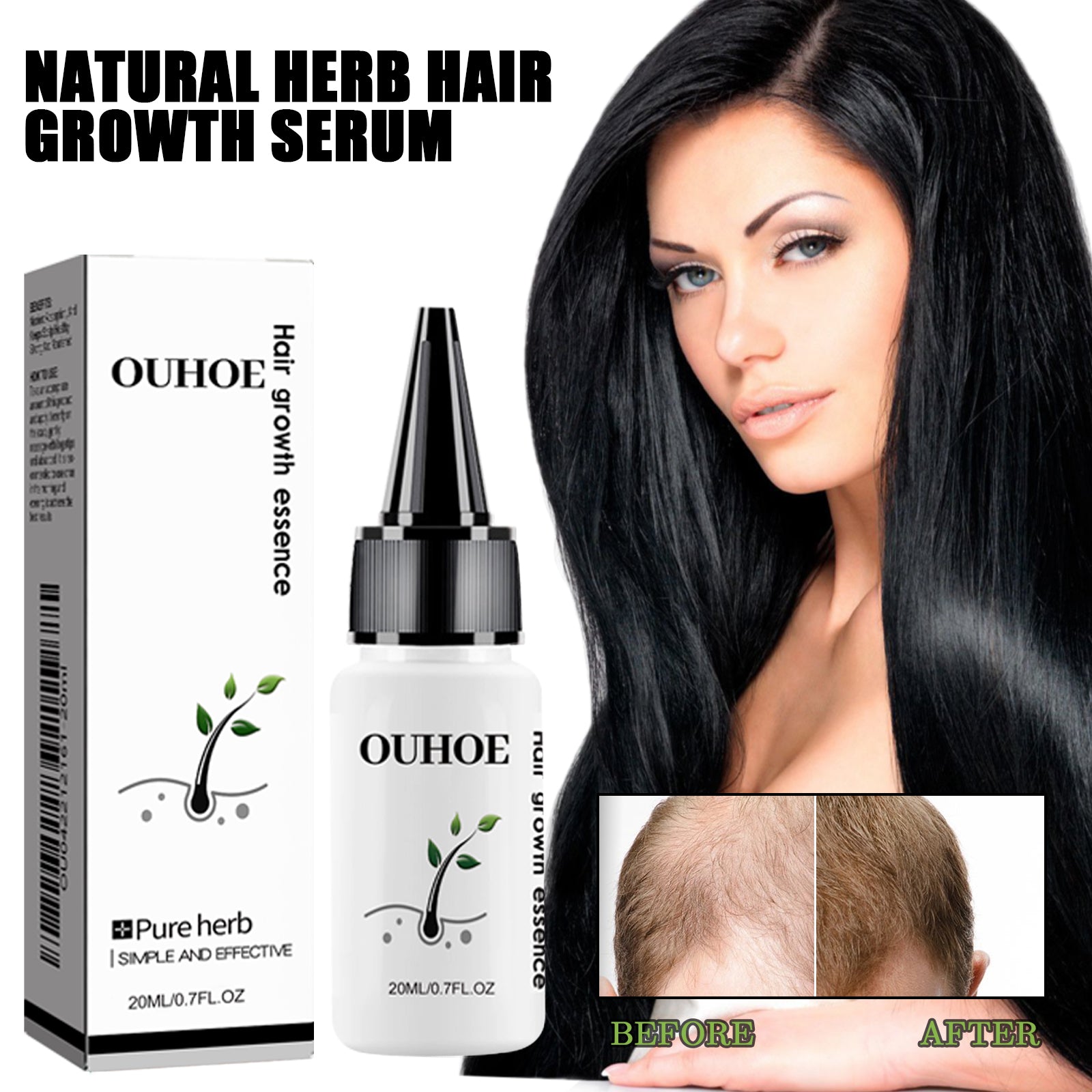 Herbal Dense Hair Essence — Scalp Nourishment for Fuller-Looking Hair — product photo 2