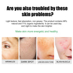 EELHOE Clear Skin Duo Cream — Blemish & Acne-Prone Skin Care — product photo 5