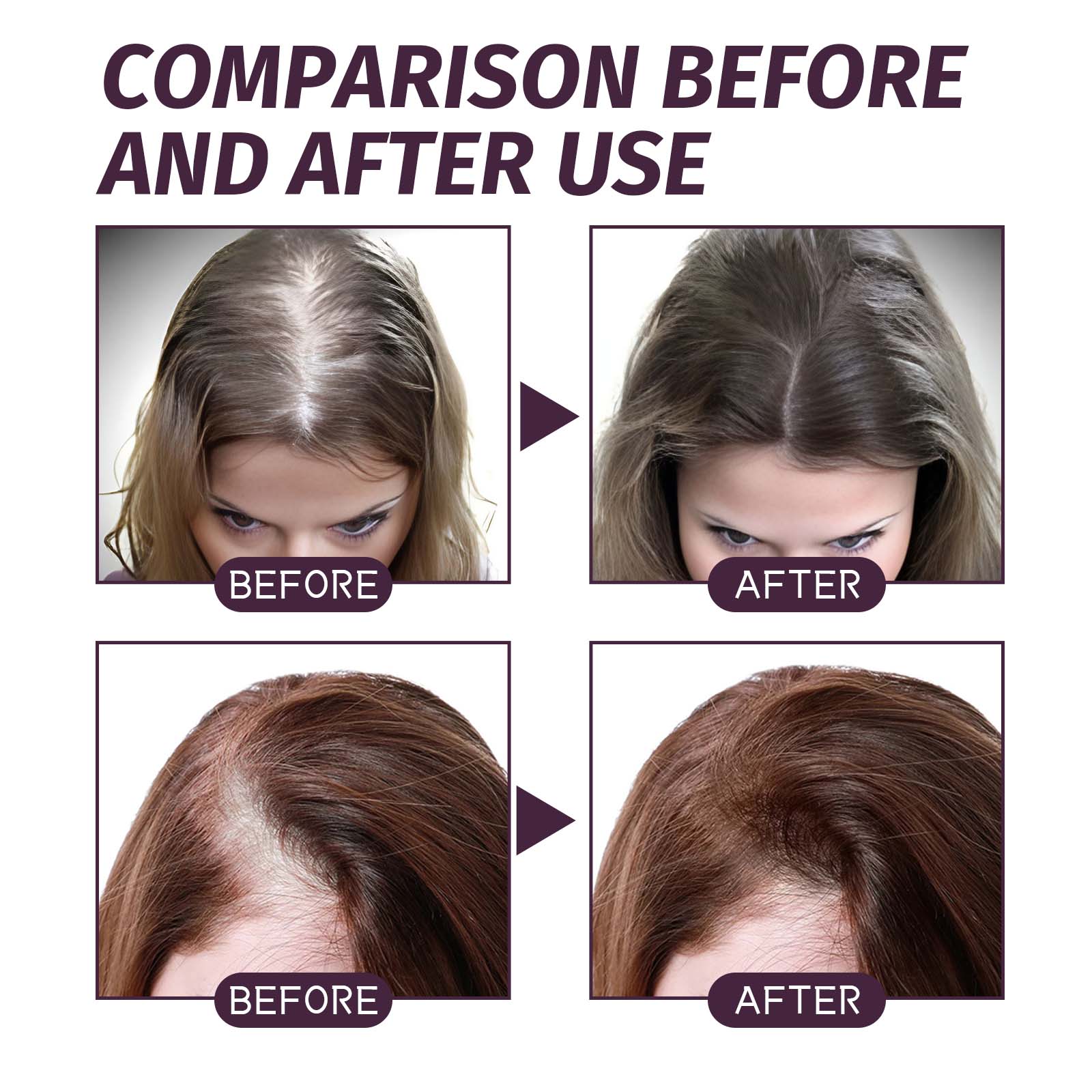 Volumizing Dense Hair Spray — Strengthening Treatment for Fine, Flat Hair — product photo 4