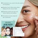 Hydrocolloid Blemish Patches — Soothing Spot Care Skincare Set — product photo 3