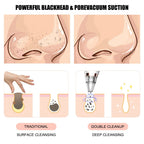 Electric Blackhead Vacuum Pore Cleanser — Rechargeable Deep-Cleansing Device — product photo 1