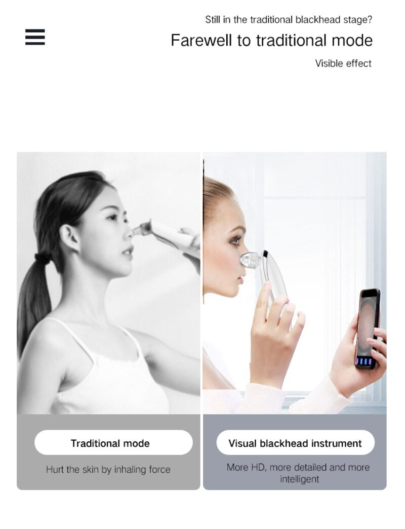 HD Camera Blackhead Vacuum — Visual Pore-Cleansing Beauty Device — product photo 5