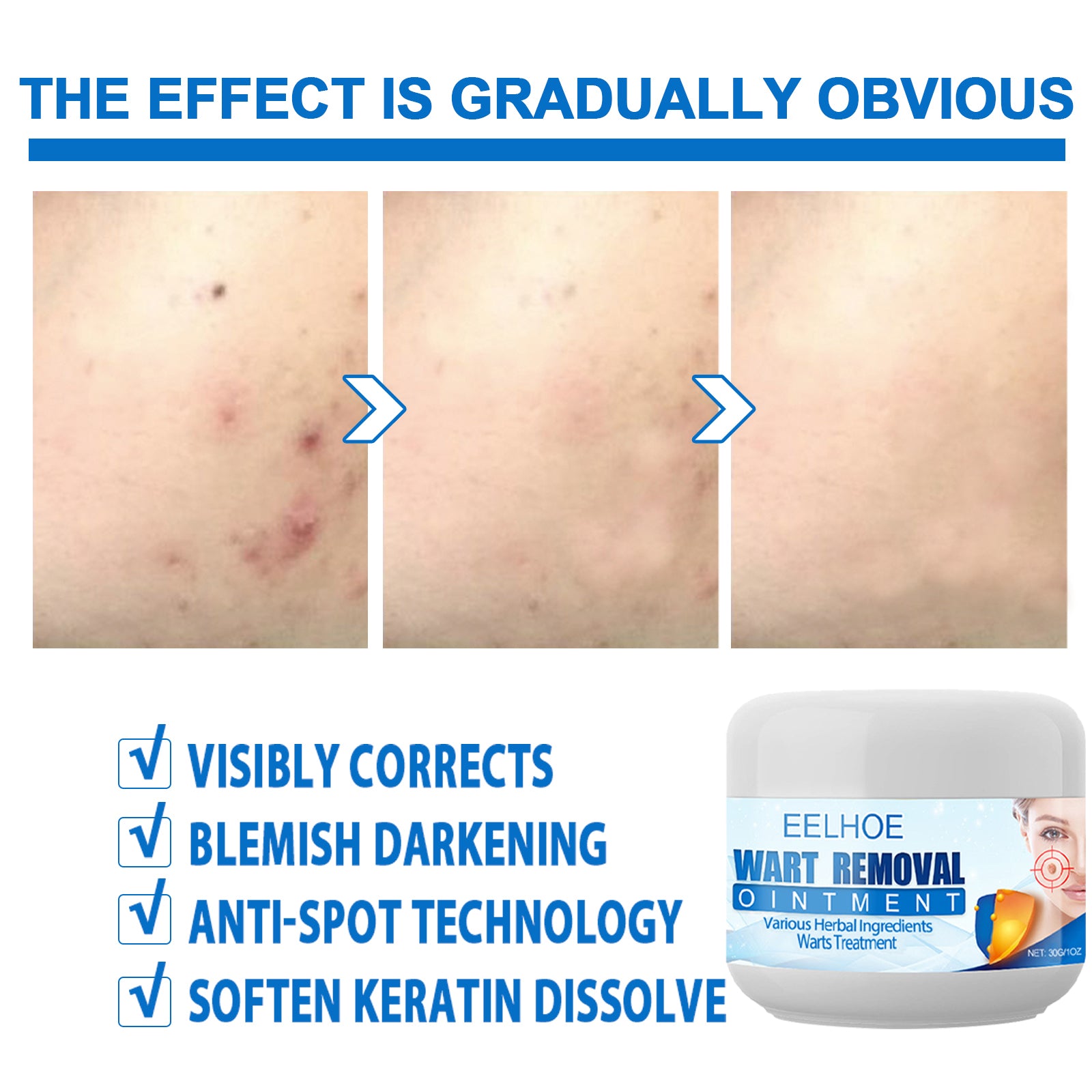 Soft Repair Body Cream — Clean-Skin Moisturizing Daily Treatment — product photo 4