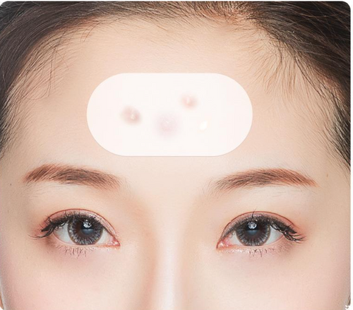 Blackhead Nose Strips & Blemish Patches — Pore-Clearing Skincare Set — product photo 2