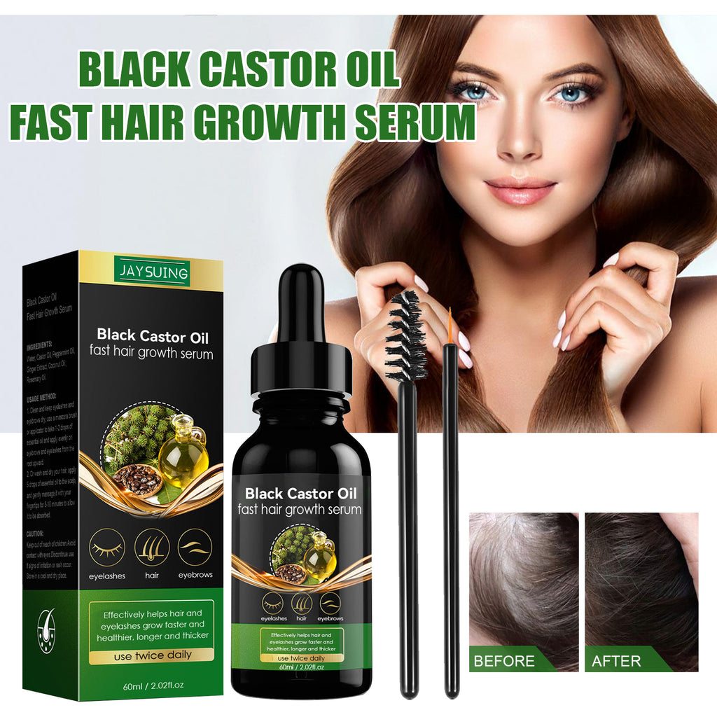 Castor Oil Hair Strengthening Serum — Thickness & Root Nourishment — product photo 1