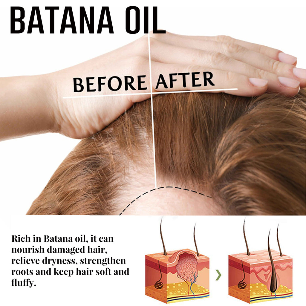 Batana Dense Hair Ball — Massage-In Root Thickening Treatment — product photo 4