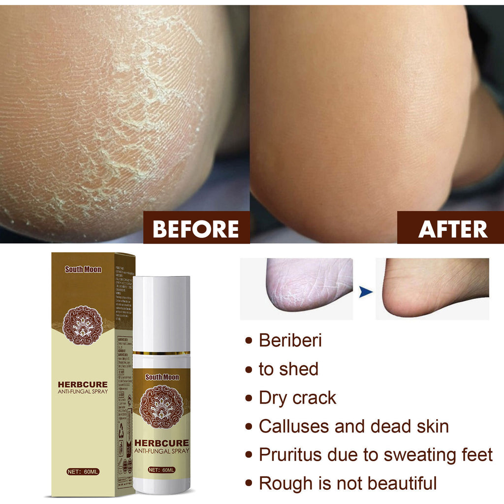 Herbal Cooling Foot Spray — Refreshing Deodorizing Foot Care — product photo 4