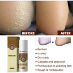 Herbal Cooling Foot Spray — Refreshing Deodorizing Foot Care — product photo 4