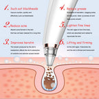 Electric Blackhead Vacuum Pore Cleanser — Rechargeable Deep-Cleansing Device — product photo 2