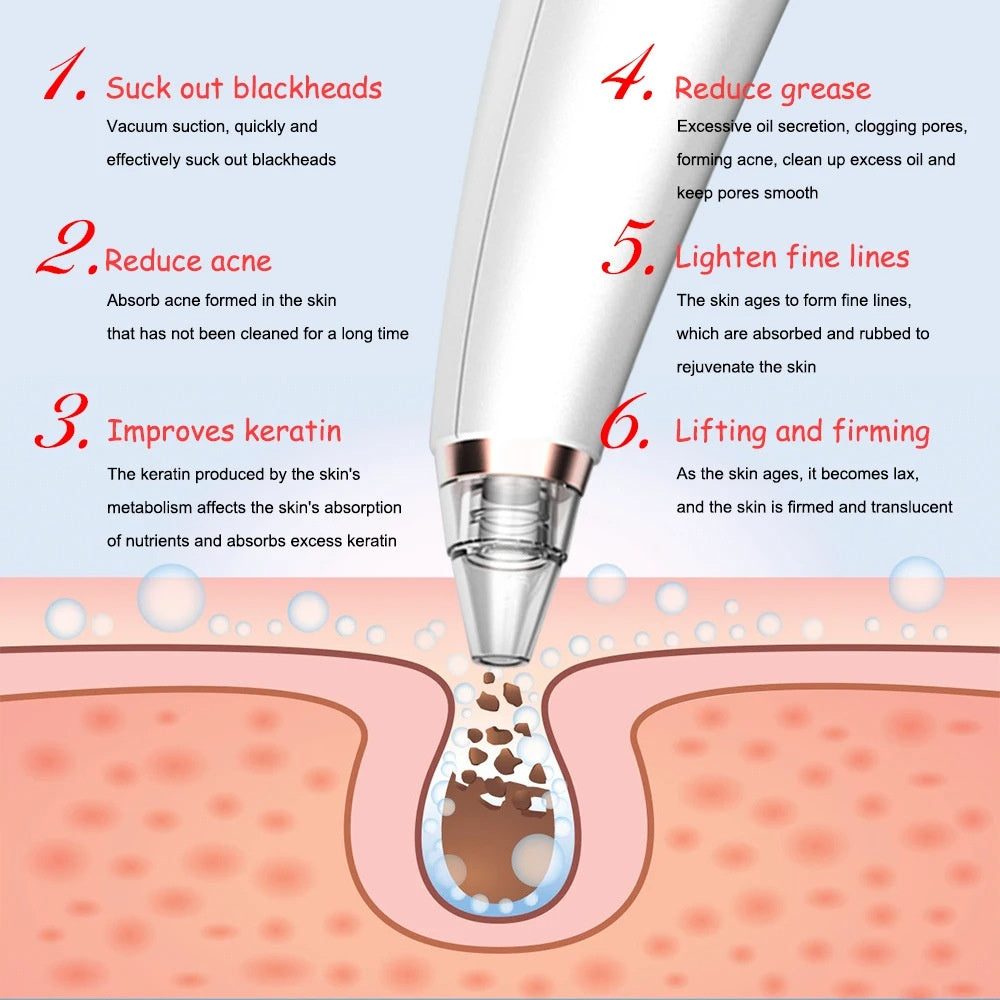 Electric Blackhead Vacuum Pore Cleanser — Rechargeable Deep-Cleansing Device — product photo 2