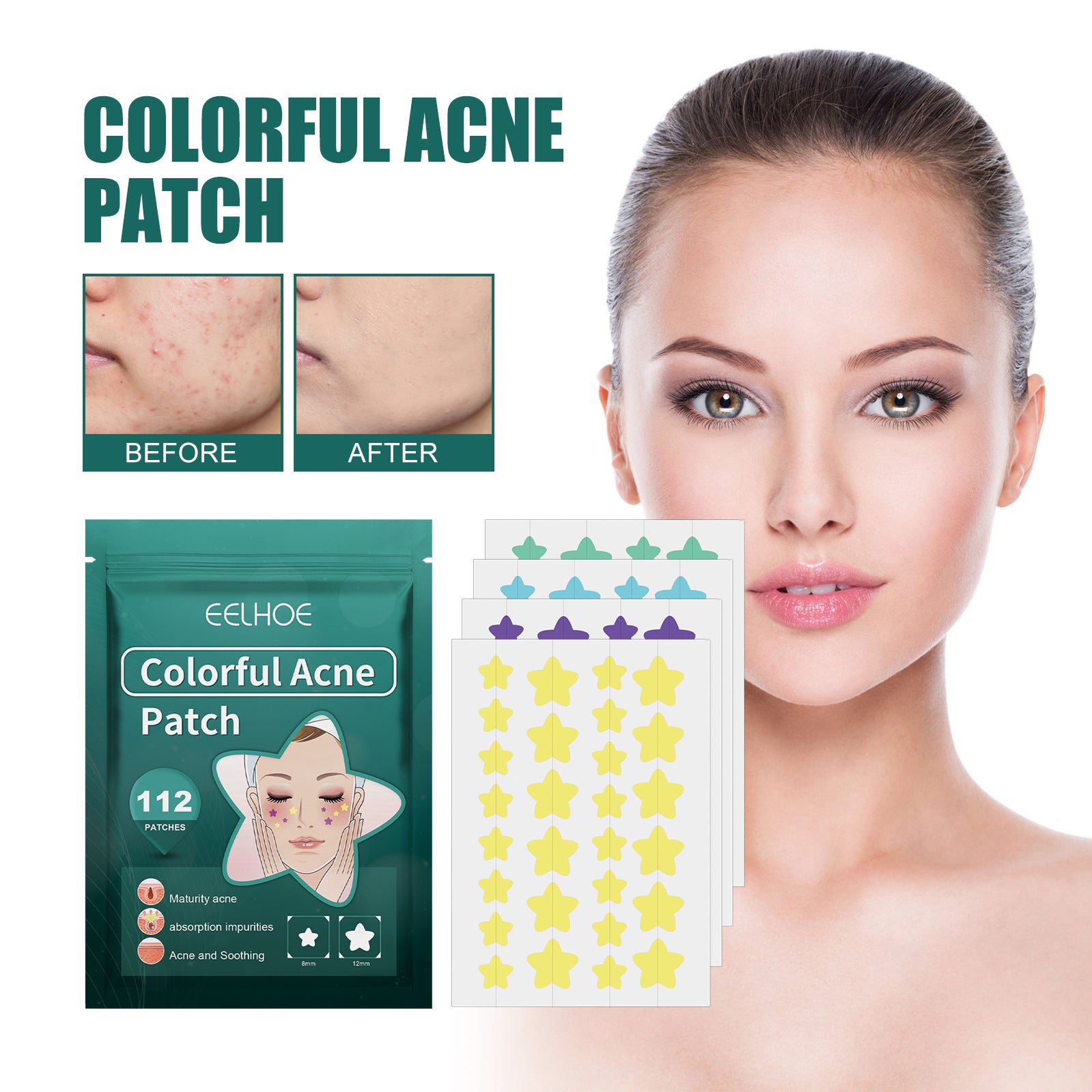 EELHOE Star Acne Patches — Cute Blemish-Calming Skin Stickers — product photo 2
