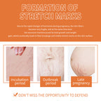 Prenatal & Postpartum Stretch Mark Massage Oil — Belly Care for New Mums — product photo 5