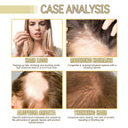 Rosemary Hair Oil — Nourishing Scalp Care for Fuller, Smoother Hair — product photo 2