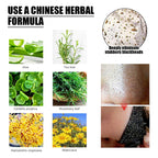 Charcoal Peel-Off Blackhead Mask — Deep-Cleansing Pore-Clearing Skincare