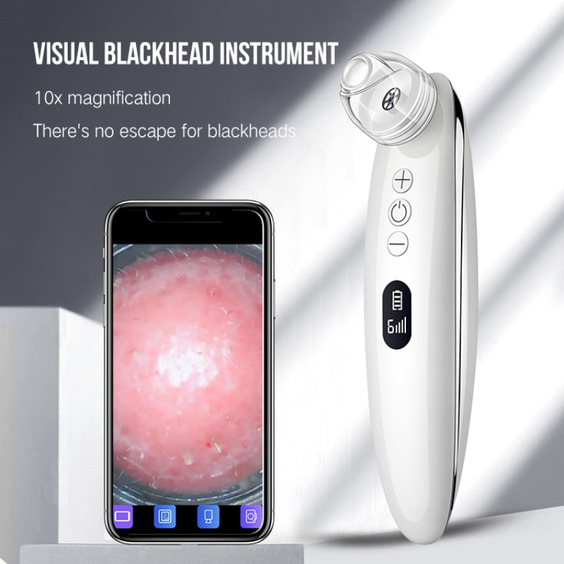 HD Camera Blackhead Vacuum — Visual Pore-Cleansing Beauty Device — product photo 1