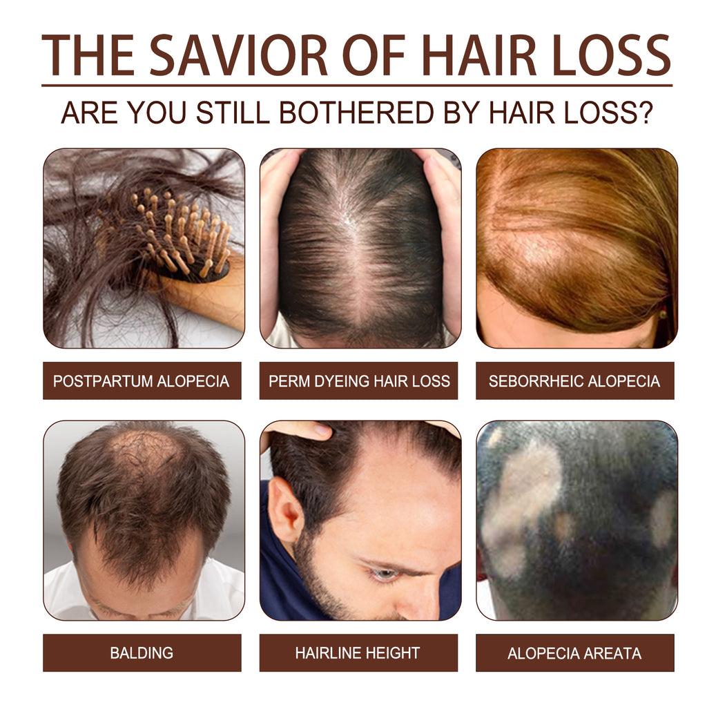 Castor Oil Dense Hair Treatment — Scalp Repair & Strand Strengthening Oil — product photo 4