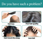 EELHOE Hair & Scalp Essence — Nourishing Soothing Hair Care — product photo 3