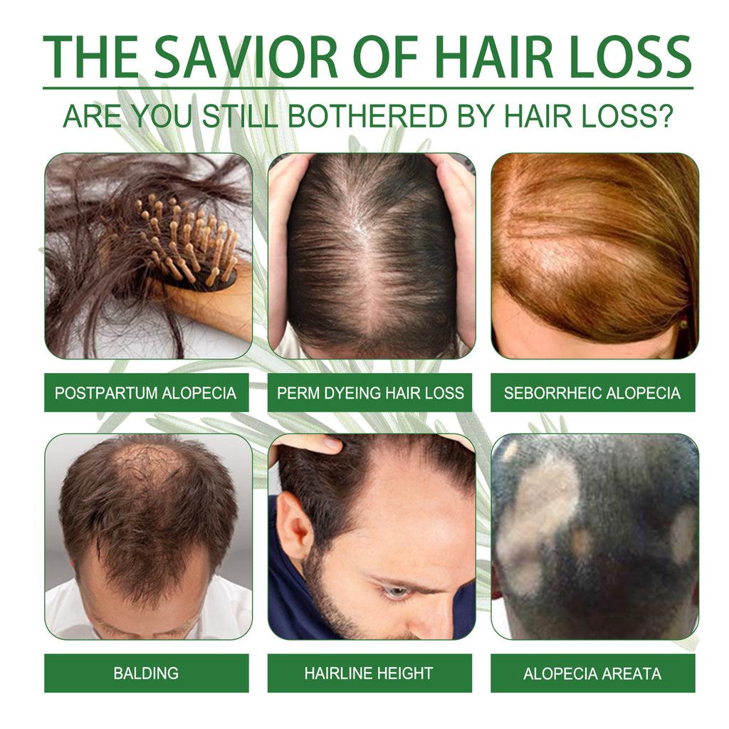 Rosemary Water Hair Strengthening Spray — Daily Scalp & Root Mist — product photo 4