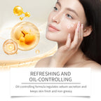 Acne Care Skincare Set — Moisturizing Routine for Blemish-Prone Skin — product photo 3