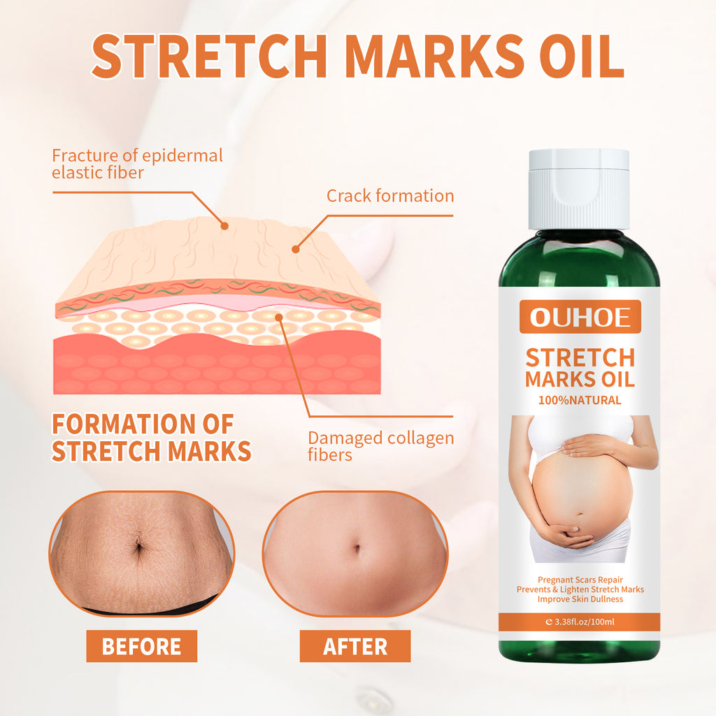 Prenatal & Postpartum Stretch Mark Massage Oil — Belly Care for New Mums — product photo 4