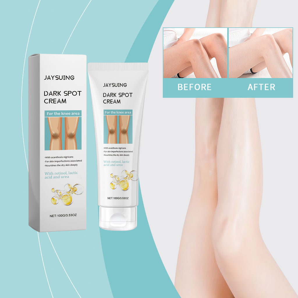 Knee Repair Moisture Cream — Softening Care for Dry, Rough Knees — product photo 1