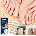 Toe Nail Care Patches — Cushioning Comfort Support for Nails — product photo 1