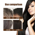 Black Hair Restore Essence — Scalp Massage Lotion for Rich, Dark Hair (30/60ml) — product photo 3