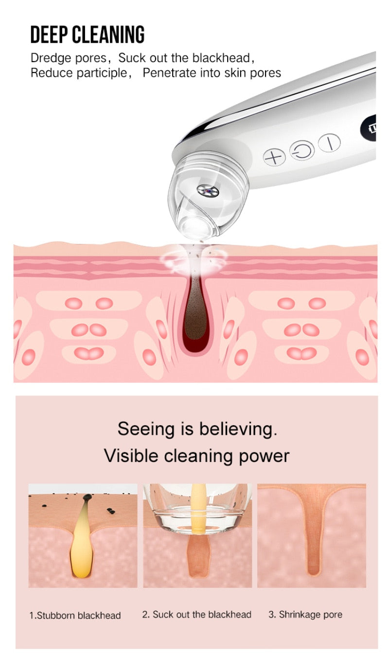 HD Camera Blackhead Vacuum — Visual Pore-Cleansing Beauty Device — product photo 4