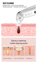 HD Camera Blackhead Vacuum — Visual Pore-Cleansing Beauty Device — product photo 4