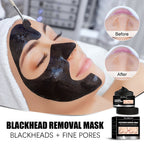 Charcoal Peel-Off Blackhead Mask — Deep-Cleansing Pore-Clearing Skincare