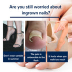 Toe Nail Care Patches — Cushioning Comfort Support for Nails — product photo 4