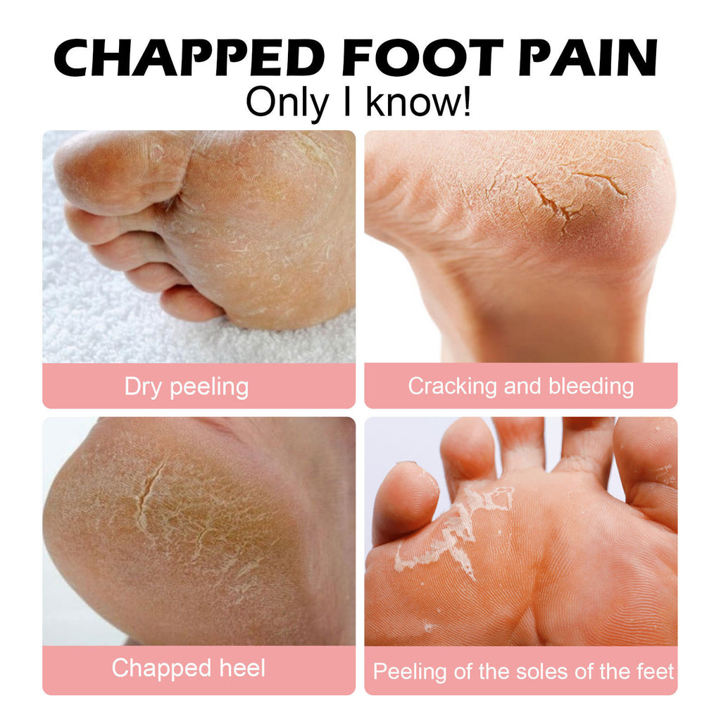 Hand & Foot Moisturizing Stick — Nourishing Balm for Dry Skin Body Care — product photo 3