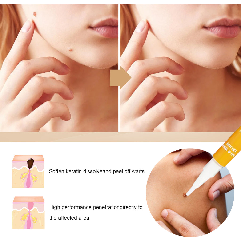 EELHOE Skin Repair Liquid Pen — Smoothing Care for Face, Neck & Body — product photo 4