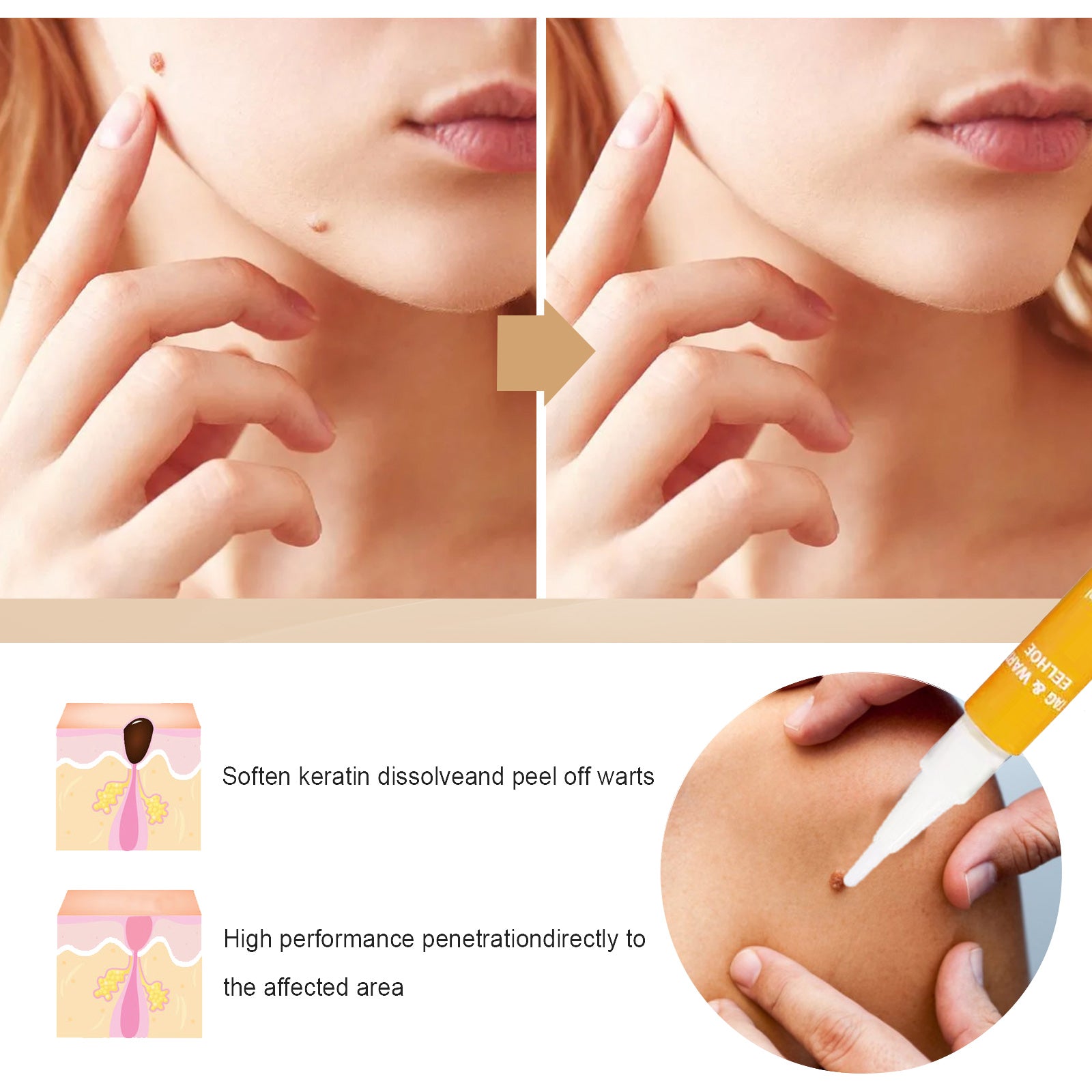 EELHOE Skin Repair Liquid Pen — Smoothing Care for Face, Neck & Body — product photo 4