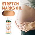 Prenatal & Postpartum Stretch Mark Massage Oil — Belly Care for New Mums — product photo 1