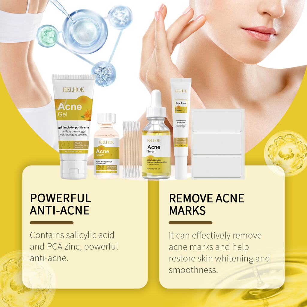 Acne Care Skincare Set — Moisturizing Routine for Blemish-Prone Skin — product photo 4