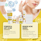 Acne Care Skincare Set — Moisturizing Routine for Blemish-Prone Skin — product photo 4